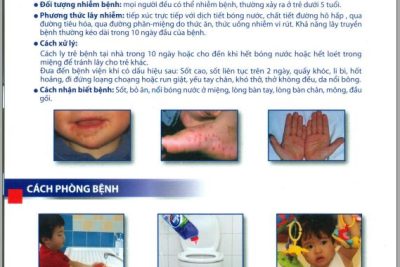 Tuyên truyền phòng chống dịch bệnh Tay-Chân – Miệng