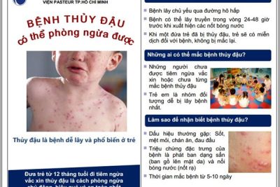 Bài tuyên truyên phòng, chống bệnh thuỷ đậu