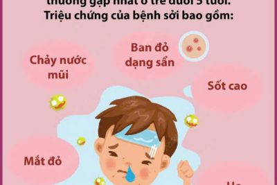 Bài tuyên truyền phòng chông bện Sởi